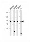DCAMKL1 Antibody (C-term)